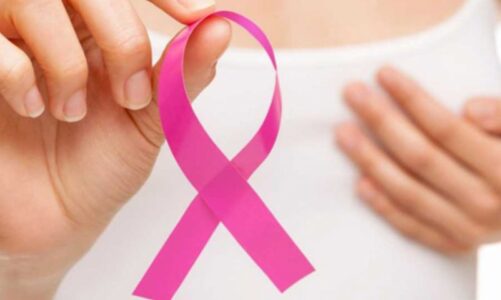 Aspectos clave de la cirugía del cáncer de mama