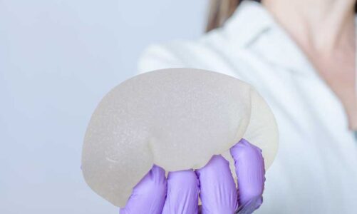 El cambio de implantes de mamas, a examen